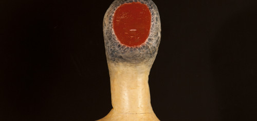 man